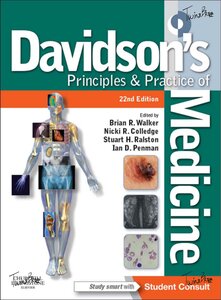 Davidson Version 22