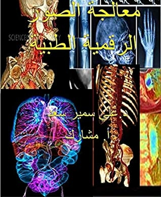 Medical Digital Image Processing