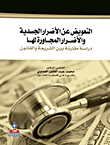 التعويض عن الأضرار الجسدية والأضرار المجاورة لها
