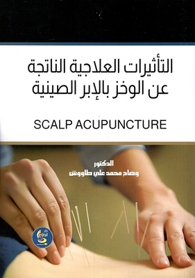 Therapeutic Effects Of Acupuncture