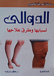Varicose Veins