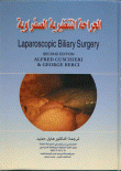 الجراحة التنظيرية الصفراوية Laparoscopic Biliary Surgery