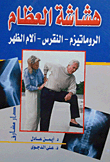 Osteoporosis - Rheumatism - Gout - Back Pain