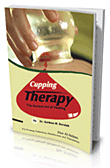 Cupping Therapy