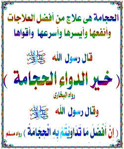 أدهشتنى الحجامة