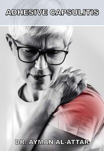 Adhesive Capsulitis