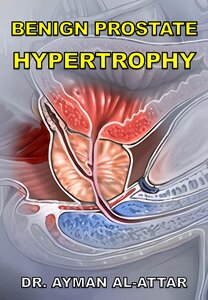Benign Prostate Hypertrophy