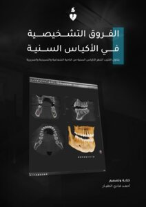 كتيب الفروق التشخيصية في الأكياس السنية