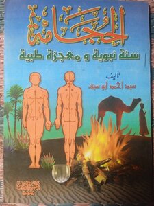 الحجامة سنة نبوية .. السيد بن أحمد أبو سيف