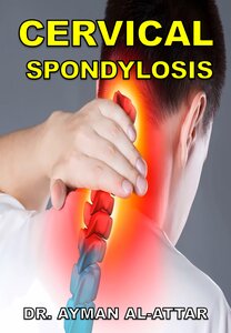 Cervical Spondylosis
