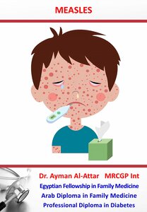 Measles