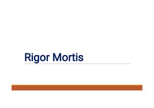 Rigor Mortis