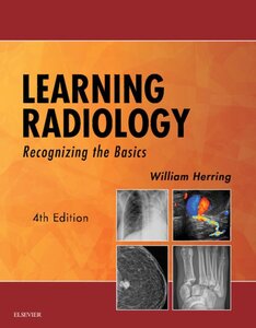 LEARNING RADIOLOGY