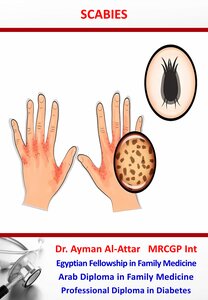 Scabies