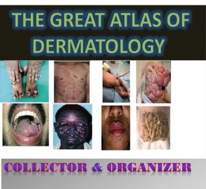 Dermatology diseases index,great atlas of dermatology