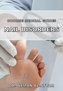Nail Disorders