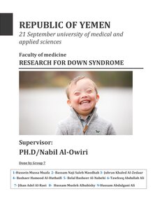 بحث عن متلازمة دوان Research for Down Syndrome