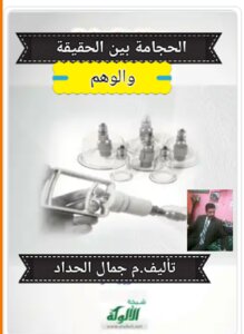 الحجامة بين الحقيقة والوهم
