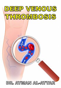 Deep Venous Thrombosis