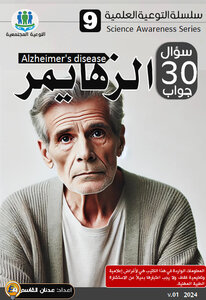الزهايمر