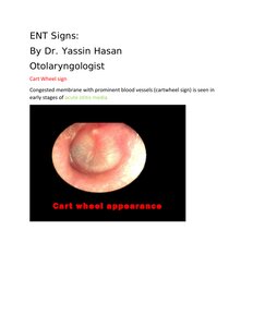 علامات شعاعية و سريرية في اختصاص امراض الاذن والانف والحنجرة