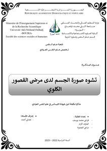 مذكرةليسانس بعنوان تشوه صورة الجسم لدى مرضى القصور الكلوي