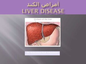 امراض الكبد في طب الاسنان