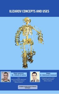 Ilizarov's Concepts And Uses Dr Massoud's Notes