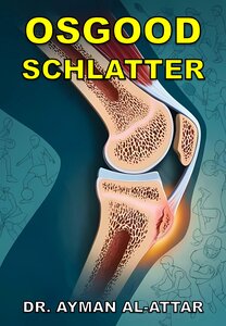 Osgood Schlatter
