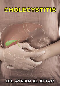 Cholecystitis