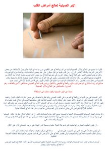 Chinese Acupuncture Treats Heart Diseases